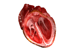 Computer Generated Cross Section 3d Model of Heart